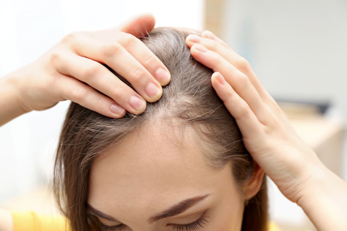beneficios de la cebolla para el pelo